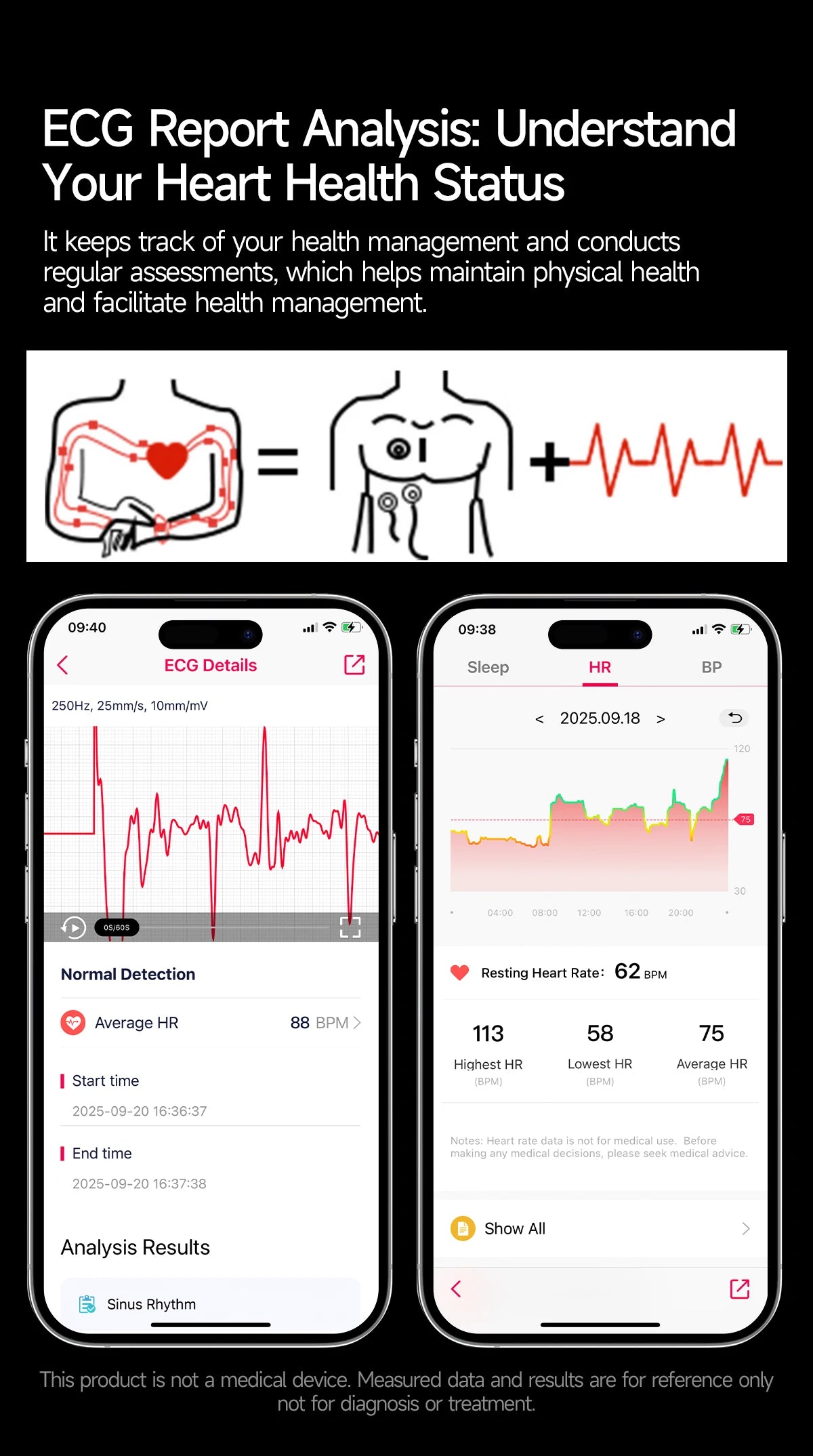 2026 New Accurate Diagnosis Smart Watch Body Fat ECG Blood oxygen BP Health Sport HD AMOLED Screen call Smart watch Men women