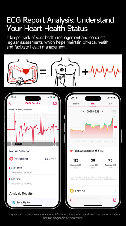 2026 New Accurate Diagnosis Smart Watch Body Fat ECG Blood oxygen BP Health Sport HD AMOLED Screen call Smart watch Men women